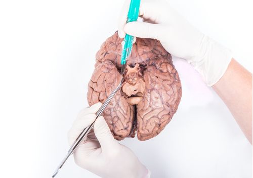 Disección de fibras blancas y neuroanatomía aplicada