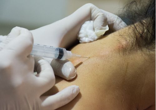 imagen e-commerce a0gPd000001MKxBIAW_Terapia-neural-superficial-aplicaciones-consulta-externa.JPG